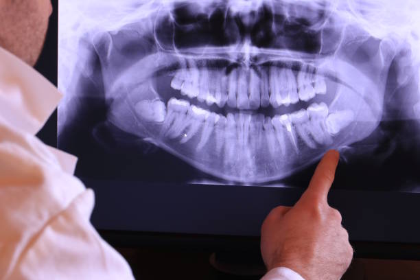 Best Emergency TMJ Treatment in Westchester, FL
